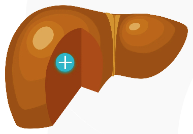 Illustration of an inflamed liver