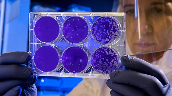 PR Newswire: Helio Genomics Presents Three Abstracts at DDW 2025