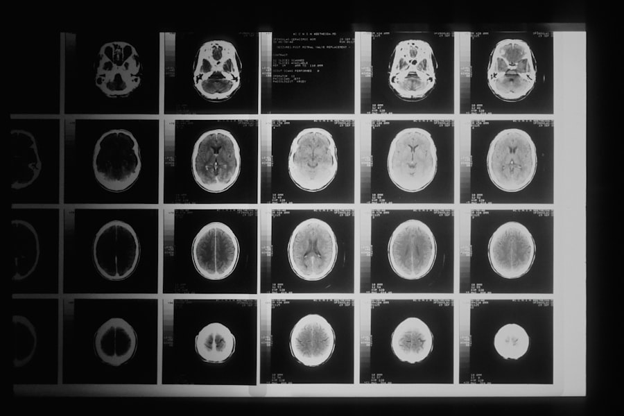 CT and MRI brain and body scan images on a diagnostic display